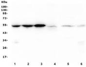 Desmin Antibody Rat and Mouse WB. Western blot testing of 1) rat heart, 2) rat skeletal muscle, 3) mouse heart, 4) mouse skeletal muscle, 5) human K562 and 6) rat liver lysate with Desmin antibody. Predicted molecular weight ~54 kDa.