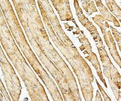 Desmin Antibody Rat Muscle Immunohistochemistry. IHC analysis of FFPE rat skeletal muscle with Desmin antibody. HIER: boil tissue sections in pH6, 10mM citrate buffer, for 20 min and allow to cool before testing.