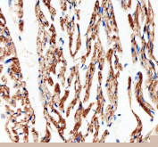 Immunohistochemical staining of FFPE mouse heart tissue with Connexin 43 antibody, HRP-secondary and DAB substrate. HIER: boil tissue sections in pH8 EDTA for 20 min and allow to cool before testing.