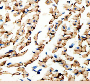 Immunohistochemical staining of FFPE rat heart tissue with Connexin 43 antibody, HRP-secondary and DAB substrate. HIER: boil tissue sections in pH8 EDTA for 20 min and allow to cool before testing.