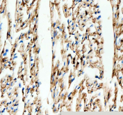Immunohistochemical staining of FFPE rat heart tissue with Connexin 43 antibody, HRP-secondary and DAB substrate. HIER: boil tissue sections in pH8 EDTA for 20 min and allow to cool before testing.