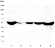 ALDH2 Antibody Human Cell Line Panel WB. Western blot analysis of ALDH2 expression was performed using anti-ALDH2 antibody in multiple human cell and tissue lysates. Lane 1: HepG2 lysate. Lane 2: placenta lysate. Lane 3: HEK293 lysate. Lane 4: SHG-44 lysate. Lane 5: THP-1 lysate. ALDH2, also known as Aldehyde Dehydrogenase 2, is a mitochondrial enzyme that detoxifies reactive aldehydes generated during alcohol metabolism, lipid peroxidation, and oxidative stress. A prominent immunoreactive band is detected at approximately 56 kDa in all samples, corresponding to the predicted molecular weight of ALDH2. The broad expression pattern observed across hepatic, placental, neuronal, and monocytic-derived samples is consistent with the widespread requirement for mitochondrial aldehyde detoxification and cellular protection from oxidative damage. These results support the utility of ALDH2 Antibody for studies of aldehyde metabolism, mitochondrial function, oxidative stress responses, and cellular detoxification pathways.