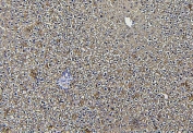 IHC staining of FFPE rat liver with Aldolase B antibody. HIER: boil tissue sections in pH6, 10mM citrate buffer, for 20 min and allow to cool before testing.