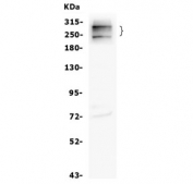 CD35 Antibody HL60 WB. Western blot testing of human HL-60 cell lysate with CD35 antibody. Expected molecular weight: 220-300 kDa.