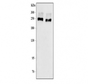 CD35 Antibody TF-1 WB. Western blot testing of human TF-1 cell lysate samples with CD35 antibody. Expected molecular weight: 220-300 kDa.