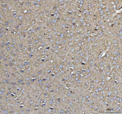 Immunohistochemical staining of FFPE rat brain tissue with CD90 antibody, HRP-secondary and DAB substrate. HIER: boil tissue sections in pH8 EDTA for 20 min and allow to cool before testing.