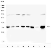 Western blot analysis of PITX2 using PITX2 antibody. PITX2 expression was examined in human Caco-2 (lane 1), HEK293 (lane 2), U2OS (lane 3), HeLa (lane 4), A549 (lane 5), and U-87MG (lane 6) whole cell lysates, as well as rat heart tissue lysates (lane 7) and mouse RAW264.7 whole cell lysates (lane 8). A predominant band is detected at approximately 35 kDa, consistent with the predicted molecular weight of PITX2 based on its amino acid sequence. A faint higher-molecular-weight band around 65-70 kDa is also observed in some samples and likely represents dimeric or incompletely reduced PITX2 species, which has been reported for homeobox transcription factors under certain reducing conditions.