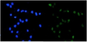 TOP2A Antibody for IF / Topoisomerase II Alpha Immunofluorescence Antibody. Immunofluorescence analysis of FFPE human U-2 OS cells using a TOP2A antibody reveals distinct nuclear fluorescence consistent with the known localization of Topoisomerase II alpha in proliferating cells. Cells were stained with TOP2A antibody (green) to visualize nuclear distribution of the DNA topoisomerase II alpha protein, while DAPI (blue) highlights cell nuclei. Antigen retrieval was performed by steaming sections in pH6 citrate buffer prior to staining to enable optimal immunofluorescence detection in FFPE cells. The merged immunofluorescence pattern demonstrates nuclear enrichment of TOP2A signal within U-2 OS cells, consistent with the role of this enzyme in DNA replication and chromosome segregation. This IF staining pattern supports the use of the TOP2A Antibody for IF in immunofluorescence microscopy studies examining nuclear protein localization, proliferating cell populations, and cell cycle associated chromatin dynamics.