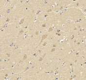 IHC staining of FFPE human brain tissue with SKP1 antibody. HIER: boil tissue sections in pH8 EDTA buffer for 20 min and allow to cool before testing.