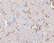 IHC staining of FFPE rat kidney with Gusb antibody. HIER: boil tissue sections in pH6, 10mM citrate buffer, for 20 min and allow to cool before testing.