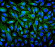 IF/ICC staining of FFPE human U-2 OS cells with Beta Tubulin antibody (green) at 2ug/ml and DAPI nuclear stain (blue). HIER: steam section in pH6 citrate buffer for 20 min.
