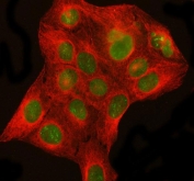 Immunofluorescent staining of FFPE human U-2 OS cells with DHX15 antibody (green) and Beta Tubulin mAb (red). HIER: steam section in pH6 citrate buffer for 20 min.