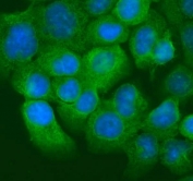 Keratin 20 Antibody for IF. Immunofluorescent staining of FFPE human A431 cells using a rabbit polyclonal Keratin 20 antibody. Green fluorescence highlights cytoplasmic Keratin 20 / Cytokeratin 20 (KRT20) intermediate filament staining in epithelial cells, while nuclei are counterstained with DAPI (blue). The staining pattern reflects the expected cytoplasmic localization of this epithelial cytoskeletal protein. HIER: steam section in pH6 citrate buffer for 20 min.
