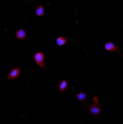 Keratin 20 Antibody for IF. Immunofluorescent staining of FFPE rat RH35 cells using a rabbit polyclonal Keratin 20 antibody. Red fluorescence highlights cytoplasmic Keratin 20 / Cytokeratin 20 (KRT20) intermediate filament staining within epithelial-derived cells, while nuclei are counterstained with DAPI (blue). The staining pattern demonstrates cytoplasmic localization consistent with intermediate filament organization of this epithelial cytoskeletal protein. HIER: steam section in pH6 citrate buffer for 20 min.