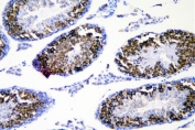 IHC staining of FFPE mouse testis with DDX4 antibody. HIER: boil tissue sections in pH8 EDTA for 20 min and allow to cool before testing.