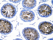 IHC staining of FFPE rat testis with DDX4 antibody. HIER: boil tissue sections in pH8 EDTA for 20 min and allow to cool before testing.
