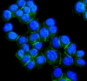 Desmoglein 2 Antibody MCF7 IF. Immunofluorescence analysis of FFPE human MCF7 cells stained with Desmoglein 2 antibody (green) detecting DSG2. Fluorescent signal outlines cell membranes with prominent localization at intercellular junctions, consistent with DSG2 distribution in desmosomal adhesion complexes that maintain epithelial cell-cell cohesion. Cytoplasmic signal is lower relative to strong junctional staining. DAPI nuclear stain (blue) highlights nuclei. HIER: steam section in pH 6 citrate buffer for 20 min.