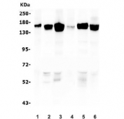 Desmoglein 2 Antibody Multi-Sample WB. Western blot analysis of human lysates using Desmoglein 2 antibody detecting DSG2. Lane 1: placenta, Lane 2: K562, Lane 3: HeLa, Lane 4: U-2 OS, Lane 5: HepG2, Lane 6: PC-3. A band is detected at approximately 130-160 kDa across multiple samples, consistent with the predicted molecular weight of Desmoglein 2, with size variation reflecting glycosylation of this transmembrane desmosomal cadherin. The consistent detection across epithelial-derived cell lines supports DSG2 expression as a key component of desmosomal adhesion complexes involved in maintaining cell-cell junction integrity.
