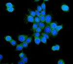 PCK2 Antibody MCF7 Breast Cancer Cell IF. PCK2 was detected in formalin-fixed, paraffin-embedded human MCF7 breast cancer cells following heat-induced epitope retrieval by steaming in citrate buffer, pH 6.0, for 20 minutes. Immunofluorescent staining shows PCK2 in green, while nuclei were counterstained with DAPI and appear blue. The observed signal is predominantly cytoplasmic and perinuclear, consistent with the mitochondrial localization of PCK2. PCK2 Antibody, a mitochondrial gluconeogenesis enzyme antibody, supports examination of PCK2 expression and subcellular distribution in breast cancer metabolism research.