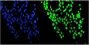Immunofluorescent staining of FFPE human A431 cells with NUP214 antibody (green) and DAPI nuclear stain (blue). HIER: steam section in pH6 citrate buffer for 20 min.