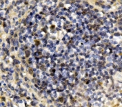 Irf3 Antibody Mouse Spleen IHC. Immunohistochemistry staining of FFPE mouse spleen with Irf3 antibody. HIER: boil tissue sections in pH8 EDTA for 20 min and allow to cool before testing.