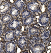IHC staining of FFPE mouse intestine with AKAP12 antibody. HIER: boil tissue sections in pH8 EDTA for 20 min and allow to cool before testing.
