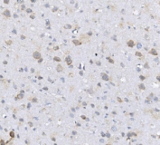 ALPL Antibody Rat Brain IHC. Immunohistochemistry analysis of FFPE rat brain tissue stained with ALPL Antibody / Phosphate Metabolism Enzyme Antibody. Scattered neuronal and glial-associated cellular populations demonstrate light to moderate cytoplasmic HRP-DAB brown staining against a low-background neuropil environment. The observed staining pattern is consistent with expression of alkaline phosphatase, tissue-nonspecific isozyme / ALPL, a phosphate metabolism enzyme implicated in extracellular phosphate regulation and neural tissue metabolic homeostasis. HIER: boil tissue sections in pH8 EDTA for 20 min and allow to cool before testing.