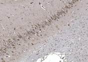 IHC staining of FFPE rat brain with NAF-1 antibody. HIER: boil tissue sections in pH8 EDTA for 20 min and allow to cool before testing.