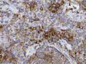 IHC staining of FFPE rat spleen with GRB10 antibody. HIER: boil tissue sections in pH8 EDTA for 20 min and allow to cool before testing.