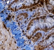 IHC staining of FFPE rat intestine with HIF1A antibody. HIER: boil tissue sections in pH8 EDTA for 20 min and allow to cool before testing.