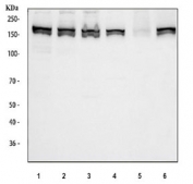 Western blot testing of 1) human K562, 2) human HeLa, 3) human 293T, 4) human HepG2, 5) rat RH35 and 6) mouse NIH 3T3 cell lysate with MSH6 antibody. Expected molecular weight: 120-160 kDa depending on phosphorylation level.