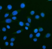 NOX5 Antibody Human SiHa Cell IF. Immunofluorescent staining of FFPE human SiHa cells with NOX5 antibody (green). Heat-induced epitope retrieval (HIER) was performed by steaming sections in pH 6 citrate buffer for 20 minutes prior to staining. Nuclei are counterstained with DAPI (blue). NOX5 immunoreactivity is observed predominantly within the cytoplasm with diffuse intracellular staining, consistent with the expected localization of this reactive oxygen species enzyme involved in calcium-dependent redox signaling.