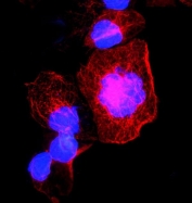 TUBA1A Antibody A431 Cell IF. Immunofluorescent staining of FFPE human A431 cells using TUBA1A Antibody demonstrates strong red cytoplasmic staining with a filamentous network pattern consistent with localization of Alpha Tubulin (TUBA1A) within the cellular microtubule cytoskeleton. TUBA1A is a highly conserved microtubule-associated protein that serves as a major structural component of microtubules, which regulate cellular architecture, intracellular transport, cell polarity, and cytoskeletal organization. The extensive filamentous staining highlights the microtubule network throughout the cytoplasm, while DAPI (blue) counterstains cell nuclei. HIER: steam tissue sections in pH 6 citrate buffer for 20 minutes prior to staining.