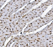 IHC staining of FFPE rat heart with Xrcc4 antibody. HIER: boil tissue sections in pH8 EDTA for 20 min and allow to cool before testing.