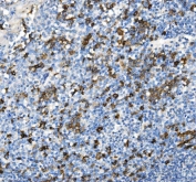 CD38 Antibody human tonsil IHC. Immunohistochemistry analysis of CD38 / plasma cell marker expression in FFPE human tonsil using a CD38 antibody. Strong membranous and cytoplasmic HRP-DAB brown staining highlights numerous plasma cells and activated lymphocytes within the tonsillar interfollicular regions, with scattered positive cells extending into germinal center-associated areas. The staining pattern demonstrates dense immune cell distribution with clear contrast against predominantly negative background lymphocytes. HIER was performed by boiling tissue sections in pH 8 EDTA buffer for 20 minutes followed by cooling prior to antibody incubation.