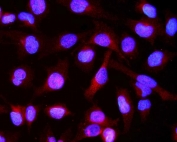 CRYAB Antibody Cytoplasmic IF. Immunofluorescence analysis of Alpha B crystallin / CRYAB in FFPE human U-2 OS cells using polyclonal CRYAB antibody. Red fluorescence highlights cytoplasmic distribution of CRYAB consistent with stress-responsive chaperone and anti-apoptotic function, while nuclei are counterstained with DAPI (blue). Heat induced epitope retrieval was performed by steaming sections in pH 6 citrate buffer for 20 min prior to staining.