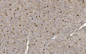 CRYAB Antibody Neural Tissue IHC. Immunohistochemistry of Alpha B crystallin / CRYAB in FFPE mouse brain tissue using polyclonal CRYAB antibody. HRP-DAB brown staining highlights scattered cytoplasmic labeling in neuronal and glial cells with a diffuse distribution, consistent with stress-response and protein stabilization functions in neural tissue, while surrounding parenchyma shows low background and nuclei are counterstained blue. Heat induced epitope retrieval was performed by boiling tissue sections in pH 8 EDTA for 20 min followed by cooling prior to staining.
