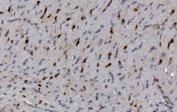 CRYAB Antibody Rat Neural IHC. Immunohistochemistry of Alpha B crystallin / CRYAB in FFPE rat brain tissue using polyclonal CRYAB antibody. HRP-DAB brown staining highlights scattered cytoplasmic labeling in neuronal and glial cells with a diffuse pattern, consistent with stress-responsive and anti-apoptotic protein expression in neural tissue, while surrounding parenchyma shows low background and nuclei are counterstained blue. Heat induced epitope retrieval was performed by boiling tissue sections in pH 8 EDTA for 20 min followed by cooling prior to staining.