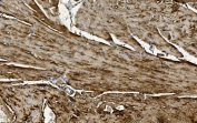 CRYAB Antibody Cardiac Stress IHC. Immunohistochemistry of Alpha B crystallin / CRYAB in FFPE mouse heart tissue using polyclonal CRYAB antibody. HRP-DAB brown staining highlights strong cytoplasmic labeling of cardiomyocytes with a linear and striated distribution, consistent with stress-responsive and anti-apoptotic protein expression in contractile tissue, while interstitial regions show lower staining and nuclei are counterstained blue. Heat induced epitope retrieval was performed by boiling tissue sections in pH 8 EDTA for 20 min followed by cooling prior to staining.