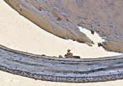 CRYAB Antibody Ocular Tissue IHC. Immunohistochemistry of Alpha B crystallin / CRYAB in FFPE rat eyeball tissue using polyclonal CRYAB antibody. HRP-DAB brown staining highlights cytoplasmic labeling within retinal and lens-associated cellular layers, consistent with stress-responsive and anti-apoptotic protein expression in ocular tissue, while surrounding structures show lower background staining and nuclei are counterstained blue. Heat induced epitope retrieval was performed by boiling tissue sections in pH 8 EDTA for 20 min followed by cooling prior to staining.