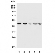Inhibin alpha Antibody Rabbit Polyclonal western blot analysis. Western blot testing of human and rodent lysates using Inhibin alpha Antibody Rabbit Polyclonal. Lane 1: human K562 lysate, Lane 2: human HeLa lysate, Lane 3: rat brain lysate, Lane 4: mouse spleen lysate, Lane 5: mouse SP2/0 lysate. A band is detected at approximately 40 kDa, consistent with the predicted molecular weight of Inhibin subunit alpha (INHA).