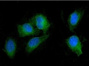 SEZ6L Antibody U-2 OS IF. Immunofluorescent staining of FFPE human U-2 OS cells using SEZ6L antibody demonstrates diffuse cytoplasmic and membranous green fluorescence with mild perinuclear enrichment, consistent with localization of SEZ6L within membrane-associated and secretory pathway-related cellular compartments. Nuclear counterstain shown in blue with DAPI. HIER: steam section in pH6 citrate buffer for 20 min.