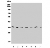 Western blot testing of human 1) HepG2, 2) Jurkat, 3) K562, 4) A549, 5) rat liver, 6) RH35 and 7) mouse HEPA1-6 lysate with SLC25A1 antibody. Predicted molecular weight ~34 kDa, commonly observed at 30-34 kDa.