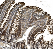 IHC staining of FFPE rat intestine with ACO1 antibody. HIER: boil tissue sections in pH8 EDTA for 20 min and allow to cool before testing.