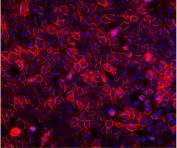 EGF Receptor Antibody for IF A431 Staining. Immunofluorescence analysis of FFPE human A431 cells stained with EGF receptor antibody detecting EGFR (red). Prominent membranous staining outlines epithelial cell borders with additional cytoplasmic signal, consistent with EGFR localization as a receptor tyrosine kinase and its trafficking following activation. The staining highlights dense epithelial cell populations typical of A431 cells, which are known to express high levels of EGFR. DAPI nuclear stain (blue) highlights nuclei. HIER: steam section in pH 6 citrate buffer for 20 min.