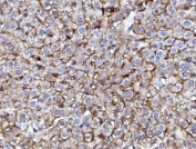 EGF Receptor Antibody Mouse Liver IHC. Immunohistochemistry staining of FFPE mouse liver with EGF Receptor antibody. HIER: boil tissue sections in pH8 EDTA for 20 min and allow to cool before testing.