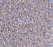 EGF Receptor Antibody Rat Liver IHC. Immunohistochemistry staining of FFPE rat liver with EGF Receptor antibody. HIER: boil tissue sections in pH8 EDTA for 20 min and allow to cool before testing.