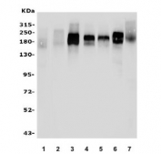 EGF Receptor Antibody WB. Western blot testing of human 1) placenta, 2) U-87 MG, 3) A431, 4) A549, 5) HeLa, 6) rat liver and 7) mouse liver lysate with EGF Receptor antibody. Expected molecular weight: 134-180 kDa depending on glycosylation level.