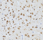 IHC staining of FFPE human brain tissue with PRMT8 antibody. HIER: boil tissue sections in pH8 EDTA for 20 min and allow to cool before testing.