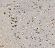 IHC staining of FFPE rat brain with Rad9b antibody. HIER: boil tissue sections in pH8 EDTA for 20 min and allow to cool before testing.